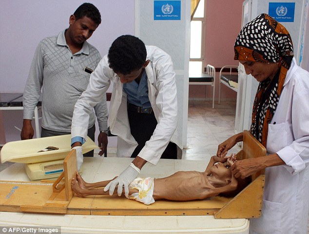 Doctors treated the child but first took accurate height and weight measurements to gauge the scale of his malnutrition | AFP / Getty Images